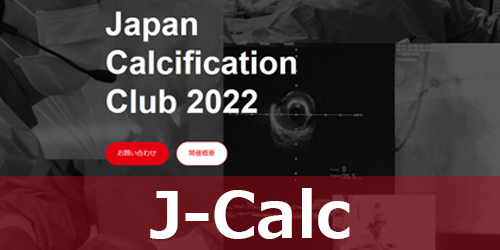 J-Calc